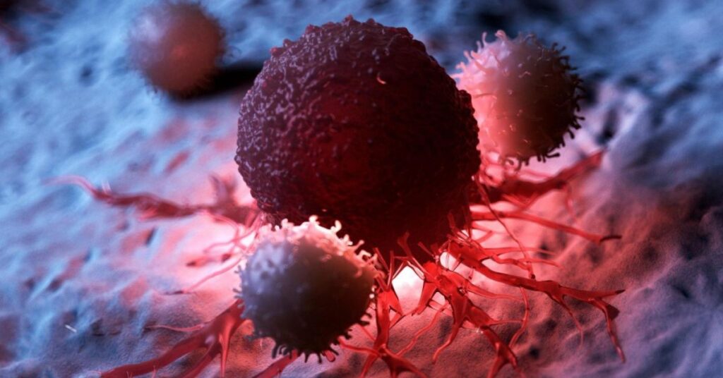 solid tumor treatment in indore